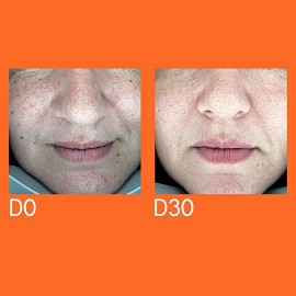 YOUTH LAB Dark Spot Remover Serum 30ml