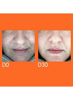 YOUTH LAB Dark Spot Remover Serum 30ml