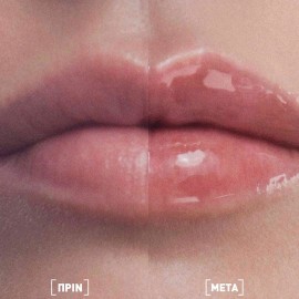 FILORGA Hyalu Lip Filler Balm Ενυδατικό Lip Balm για Γέμισμα & Όγκο στα Χείλια, 4g