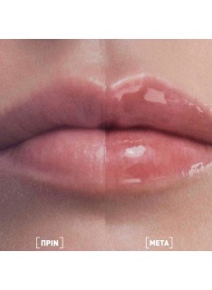 FILORGA Hyalu Lip Filler Balm Ενυδατικό Lip Balm για Γέμισμα & Όγκο στα Χείλια, 4g