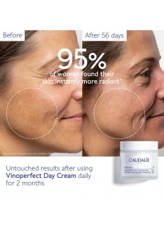 CAUDALIE Vinoperfect Dark Spot Niacinamide Moisturizer Day Cream, 50ml